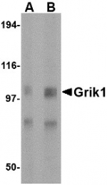 AP22601PU-N - Glutamate receptor 5 / GLUR5