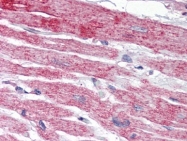 AP22602PU-N - Neuronal pentraxin-2