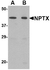 AP22602PU-N - Neuronal pentraxin-2