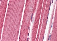 AP22606PU-N - Zygin-2