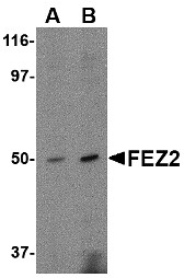 AP22606PU-N - Zygin-2