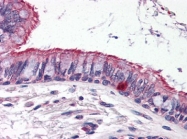 AP22607PU-N - ELOVL6