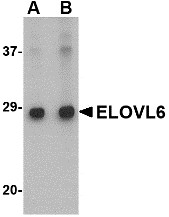 AP22607PU-N - ELOVL6