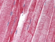 AP22608PU-N - UNC93B1