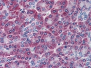 AP22609PU-N - CD248 / TEM1