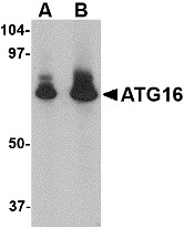 AP22610PU-N - APG16L / ATG16L1