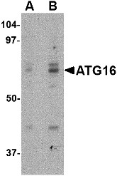AP22611PU-N - APG16L / ATG16L1