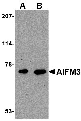 AP22615PU-N - AIF3 / AIFM3