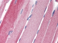 AP22616PU-N - GPAM / GPAT1
