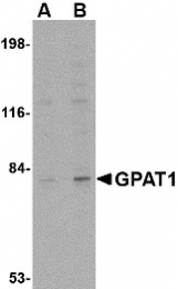 AP22616PU-N - GPAM / GPAT1