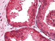 AP22617PU-N - Peroxiredoxin-3 / PRDX3