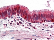 AP22618PU-N - Thioredoxin / TRX1