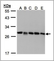 AP23171PU-N - Rab GDI beta / GDI2