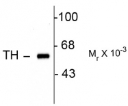 AP22626PU-N - Tyrosine 3-monooxygenase (TH)