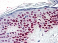 AP22629SU-N - RCC1 / CHC1