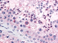AP22630SU-N - RanGAP1
