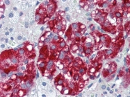 AP22634PU-N - Catenin delta-1