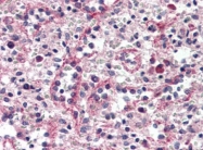AP22634PU-N - Catenin delta-1