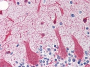 AP22638PU-N - Gamma-Synuclein / SNCG