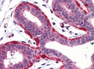 AP22638PU-N - Gamma-Synuclein / SNCG