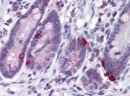 AP22640PU-N - Vitamin D3 receptor / NR1I1