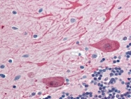 AP22641PU-N - Syntaxin 2 / STX2