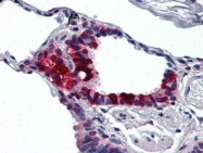 AP22645PU-N - Involucrin / IVL