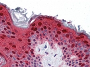 AP22645PU-N - Involucrin / IVL