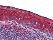 AP22645PU-N - Involucrin / IVL