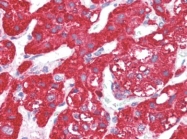 AP22653PU-N - Activin receptor type 1 / ACRV1