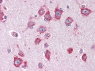 AP22653PU-N - Activin receptor type 1 / ACRV1