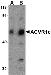 AP22653PU-N - Activin receptor type 1 / ACRV1
