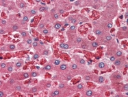 AP22655PU-N - Alpha-2-macroglobulin / A2M