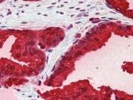 AP22659PU-N - Kallikrein-3 / PSA / KLK3