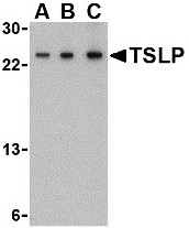 AP22662PU-N - TSLP