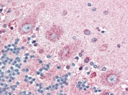 AP22663PU-N - CD294 / GPR44