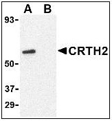 AP22663PU-N - CD294 / GPR44