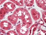 AP22664PU-N - RASD2 / TEM2
