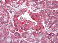 AP22664PU-N - RASD2 / TEM2