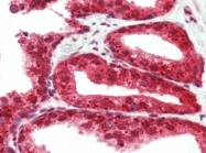 AP22664PU-N - RASD2 / TEM2