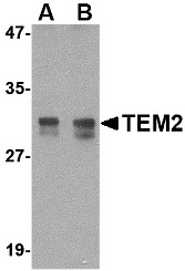 AP22664PU-N - RASD2 / TEM2