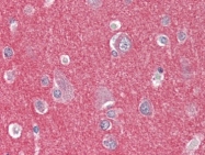 AP22665PU-N - ARHGEF17 / TEM4