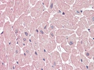 AP22665PU-N - ARHGEF17 / TEM4