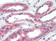 AP22665PU-N - ARHGEF17 / TEM4