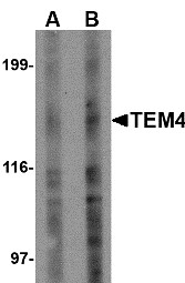 AP22665PU-N - ARHGEF17 / TEM4