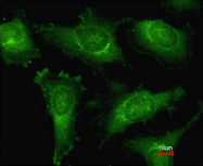 AP23169PU-N - Alpha-actinin-2 / ACTN2