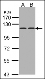 AP23168PU-N - CD249 / Glutamyl aminopeptidase