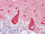AP22678PU-N - CRMP1 / DPYSL1