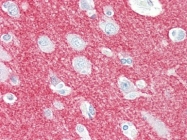 AP22678PU-N - CRMP1 / DPYSL1