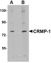 AP22678PU-N - CRMP1 / DPYSL1